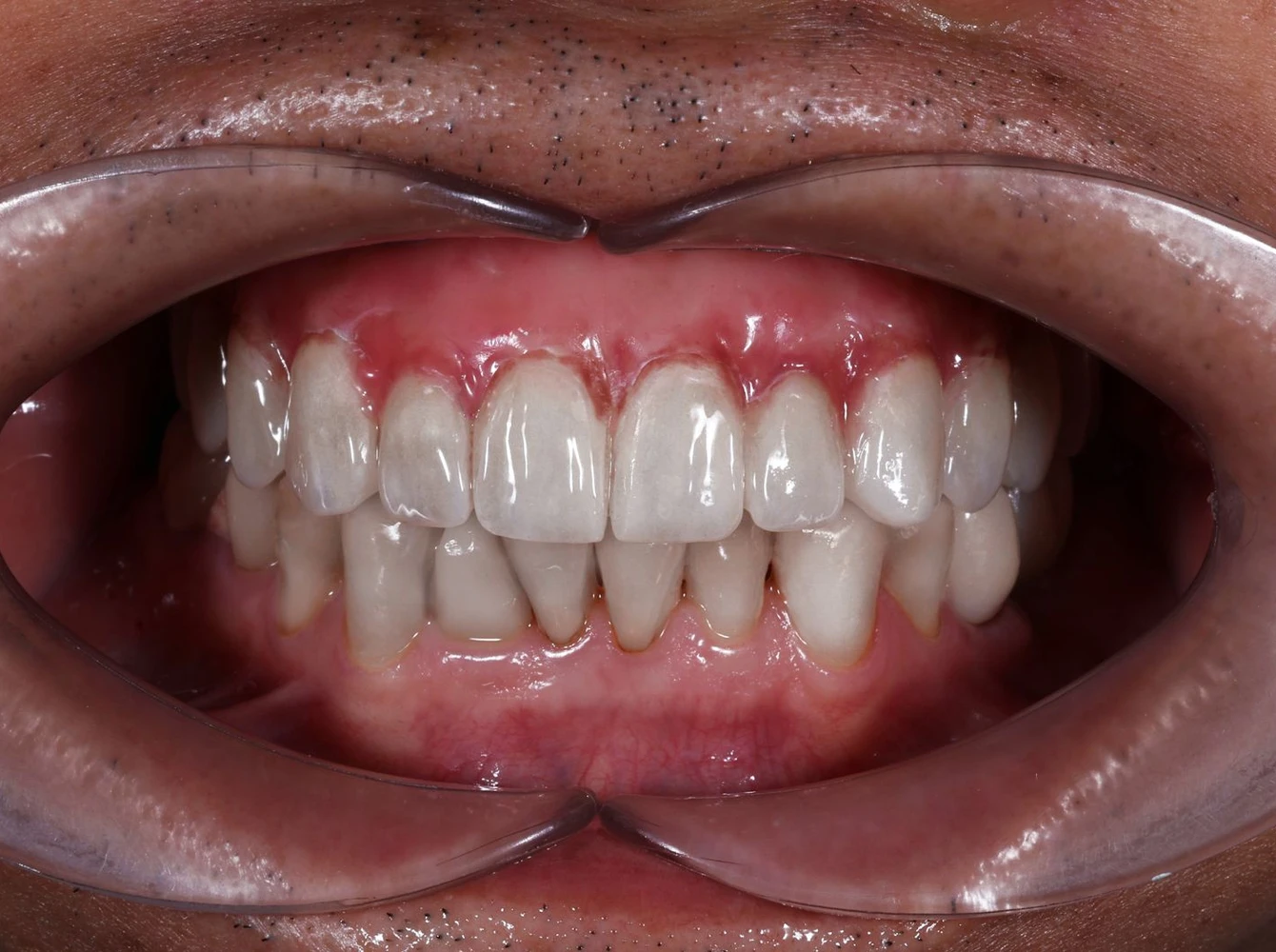 WhatsApp Image 2026-02-26 at 09.26.28